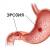 Erozja żołądka - leczenie środkami ludowymi Erozja żołądka leczenie środkami ludowymi